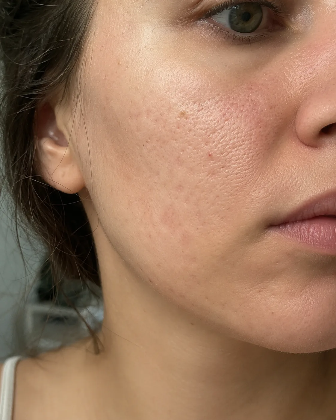 Caucasian female cheek texture