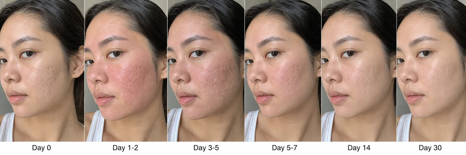Single session recovery timeline